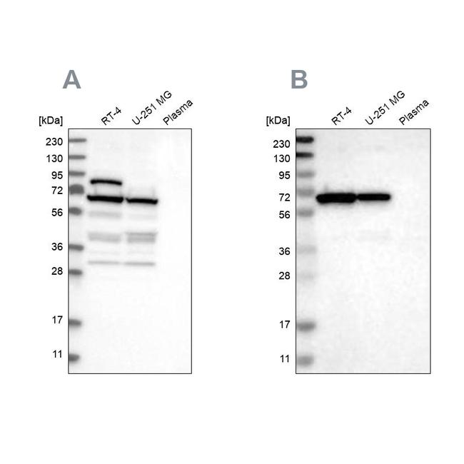 NOP58 Antibody in Western Blot (WB)