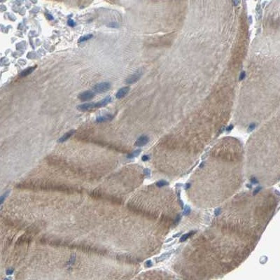 MYO18A Antibody in Immunohistochemistry (IHC)