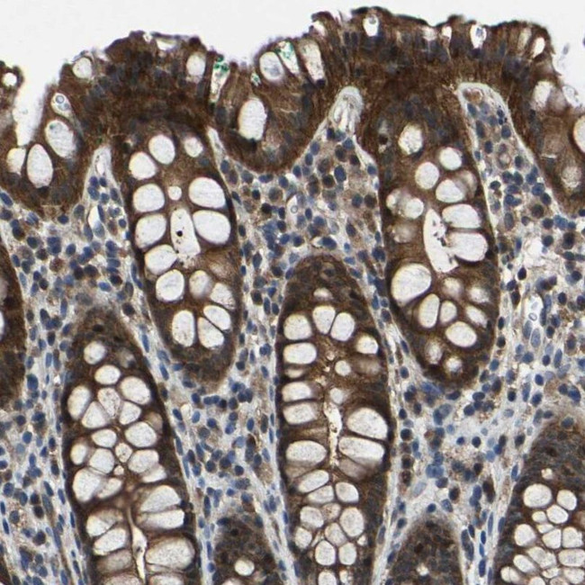 MYO18A Antibody in Immunohistochemistry (IHC)