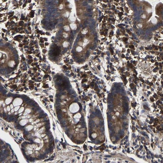 ITCH Antibody in Immunohistochemistry (IHC)