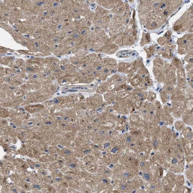 PDP1 Antibody in Immunohistochemistry (IHC)