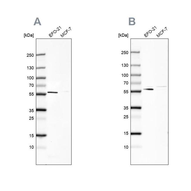 PDP1 Antibody in Western Blot (WB)