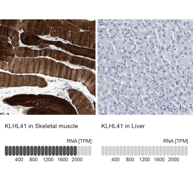 KLHL41 Antibody in Immunohistochemistry (IHC)