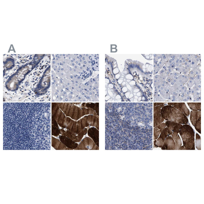 KLHL41 Antibody in Immunohistochemistry (IHC)