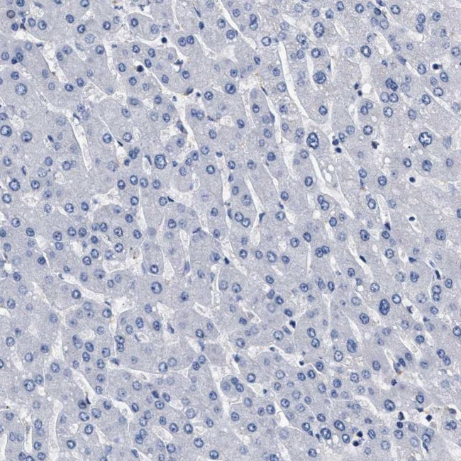 KLHL41 Antibody in Immunohistochemistry (IHC)