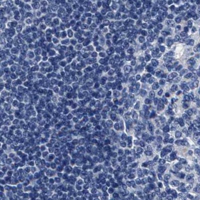 KLHL41 Antibody in Immunohistochemistry (IHC)