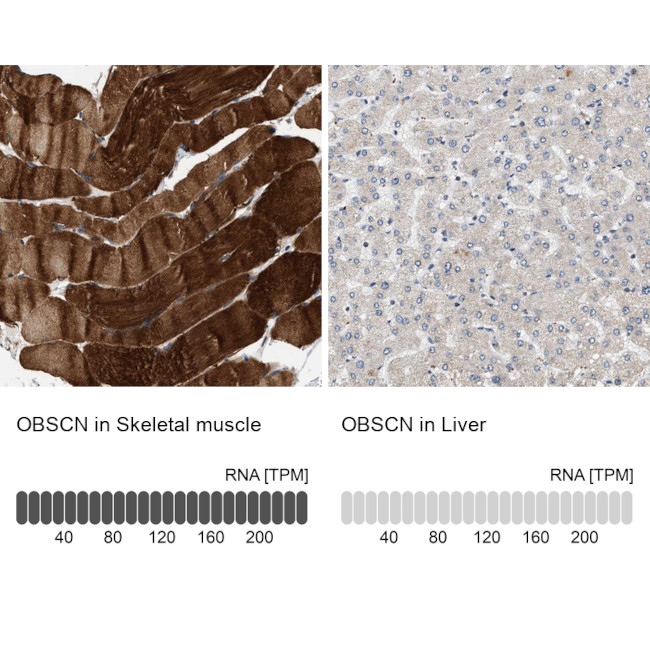 OBSCN Antibody in Immunohistochemistry (IHC)