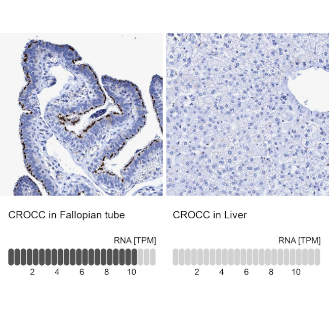 CROCC Antibody in Immunohistochemistry (IHC)