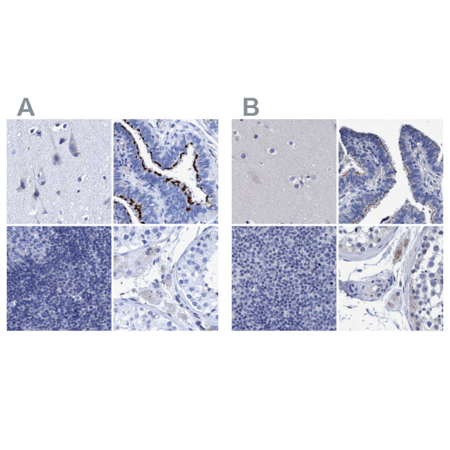 CROCC Antibody in Immunohistochemistry (IHC)