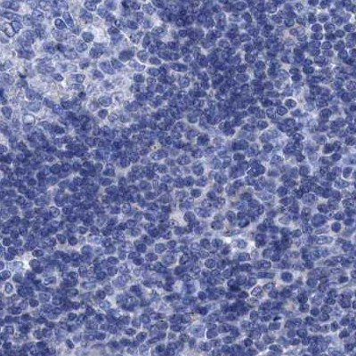 CROCC Antibody in Immunohistochemistry (IHC)