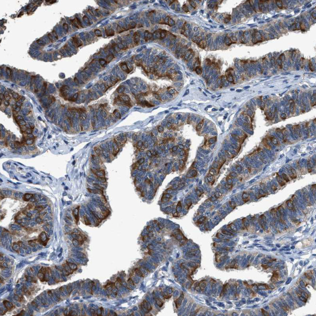 COX19 Antibody in Immunohistochemistry (IHC)