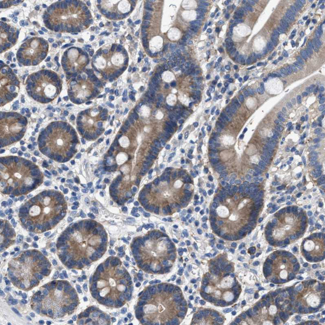 COX19 Antibody in Immunohistochemistry (IHC)