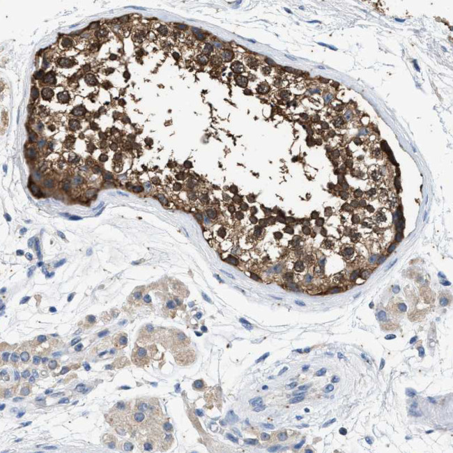 COX19 Antibody in Immunohistochemistry (IHC)