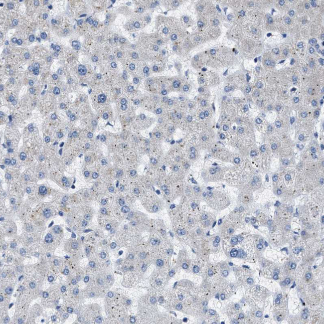 COX19 Antibody in Immunohistochemistry (IHC)