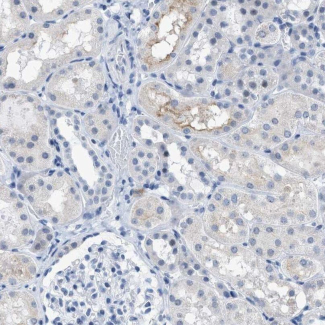 KIFC3 Antibody in Immunohistochemistry (IHC)