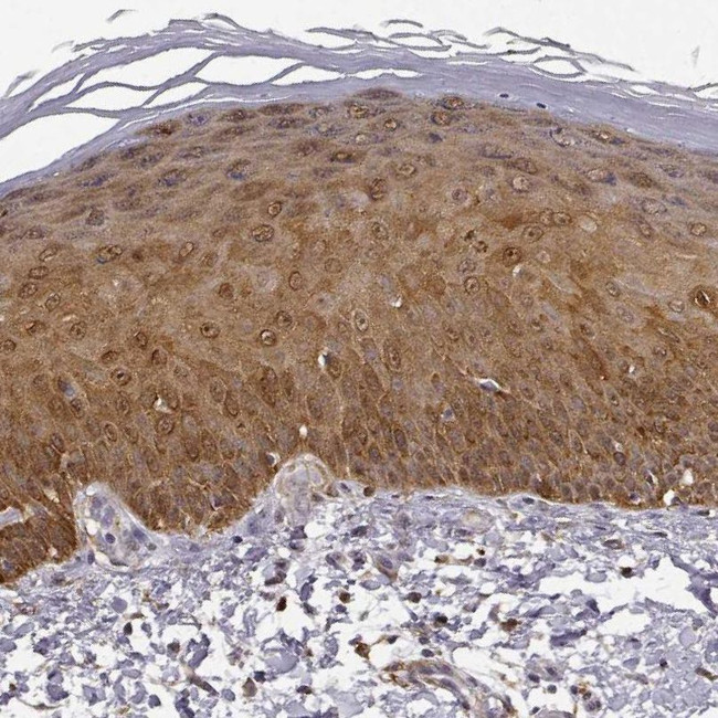 PHGDH Antibody in Immunohistochemistry (IHC)