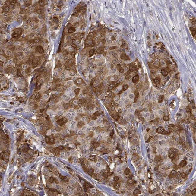 PHGDH Antibody in Immunohistochemistry (IHC)