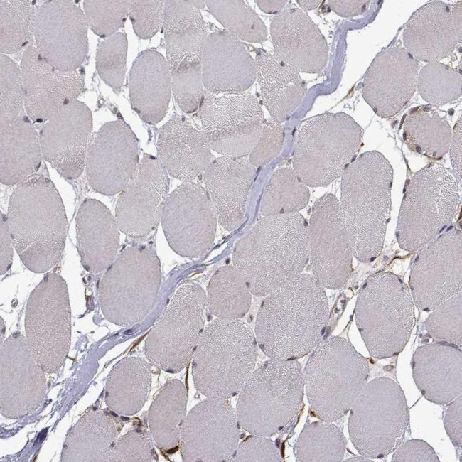 PHGDH Antibody in Immunohistochemistry (IHC)