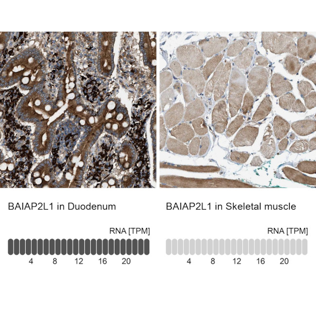 BAIAP2L1 Antibody in Immunohistochemistry (IHC)