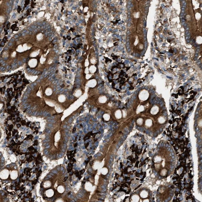 BAIAP2L1 Antibody in Immunohistochemistry (IHC)