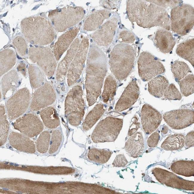 BAIAP2L1 Antibody in Immunohistochemistry (IHC)