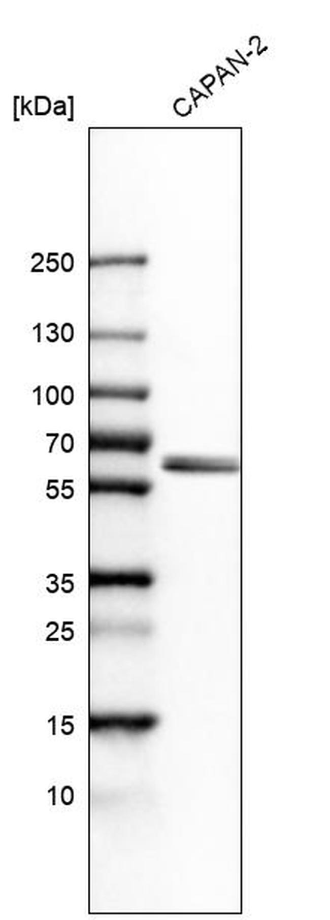 BAIAP2L1 Antibody in Western Blot (WB)