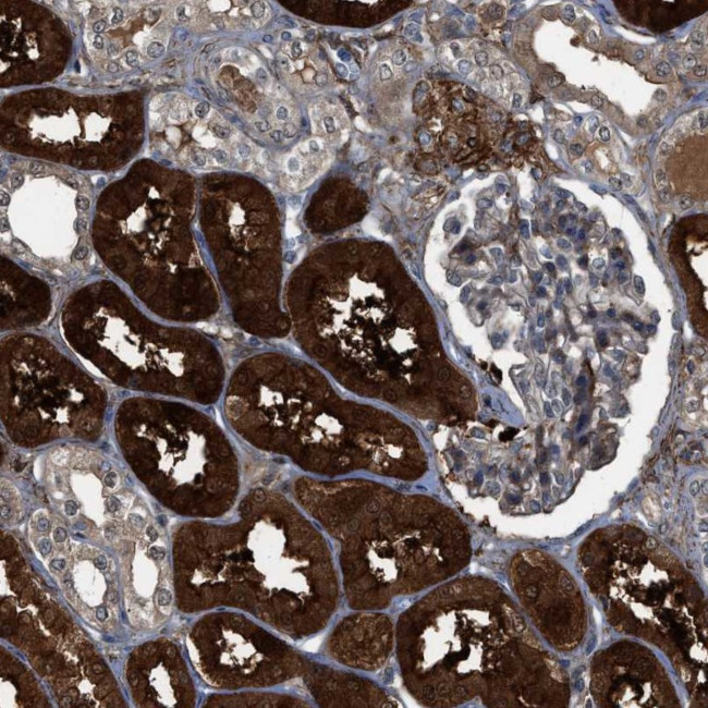 NQO2 Antibody in Immunohistochemistry (IHC)