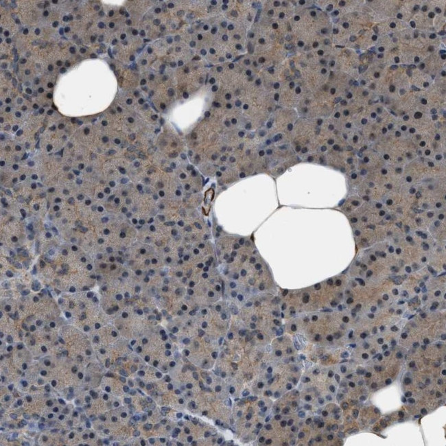 NQO2 Antibody in Immunohistochemistry (IHC)