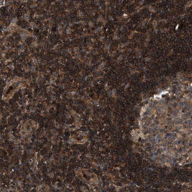 SAMD9 Antibody in Immunohistochemistry (IHC)