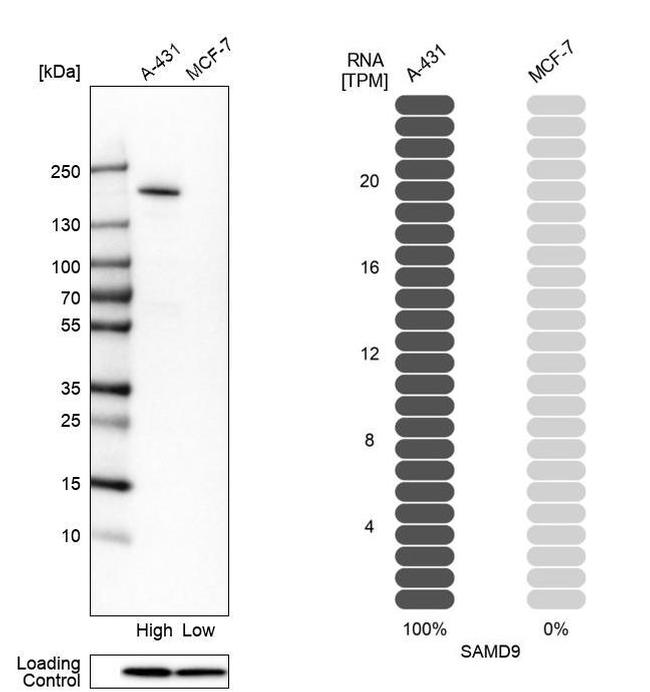 SAMD9 Antibody in Western Blot (WB)