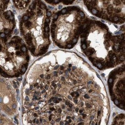 GCC1 Antibody in Immunohistochemistry (IHC)