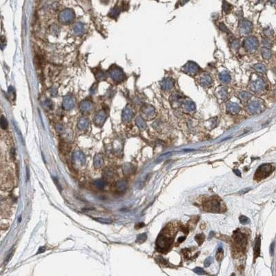 GCC1 Antibody in Immunohistochemistry (IHC)