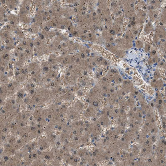 NQO2 Antibody in Immunohistochemistry (IHC)