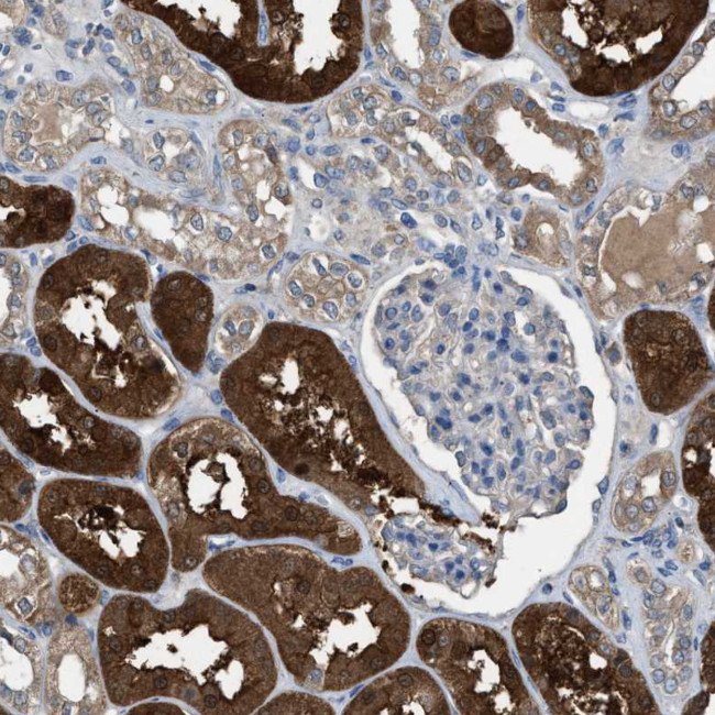 NQO2 Antibody in Immunohistochemistry (IHC)