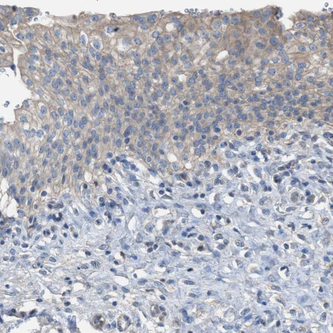 NQO2 Antibody in Immunohistochemistry (IHC)