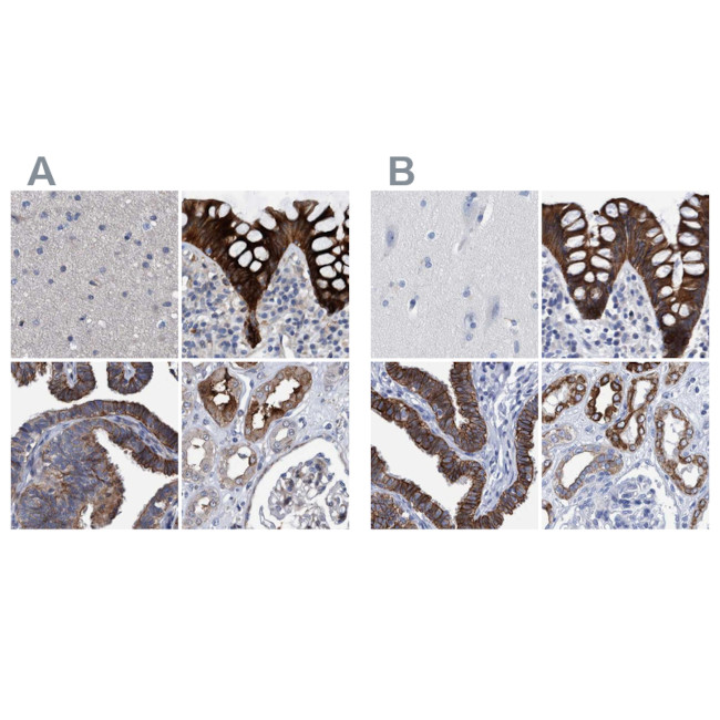 MKS1 Antibody in Immunohistochemistry (IHC)