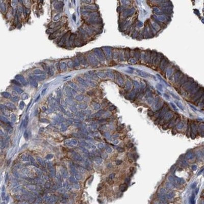 MKS1 Antibody in Immunohistochemistry (IHC)