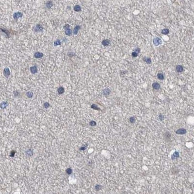 MKS1 Antibody in Immunohistochemistry (IHC)