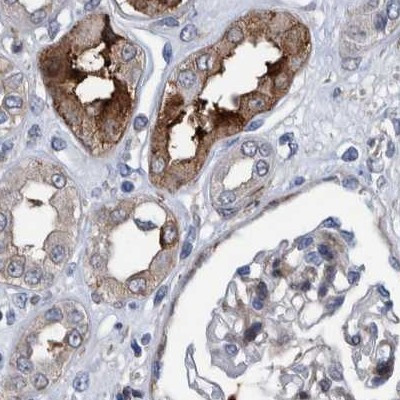 MKS1 Antibody in Immunohistochemistry (IHC)