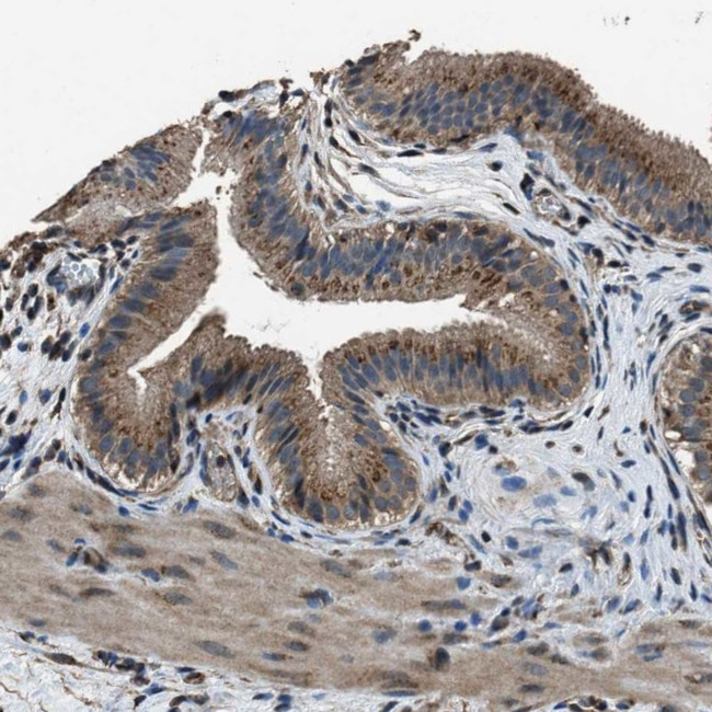 SLC38A10 Antibody in Immunohistochemistry (IHC)