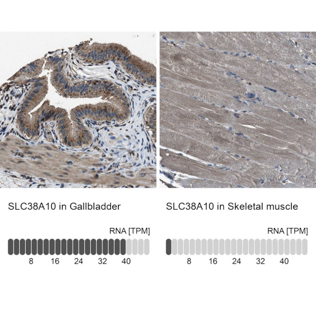 SLC38A10 Antibody