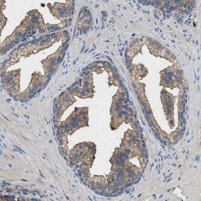 BLOC1S1 Antibody in Immunohistochemistry (IHC)