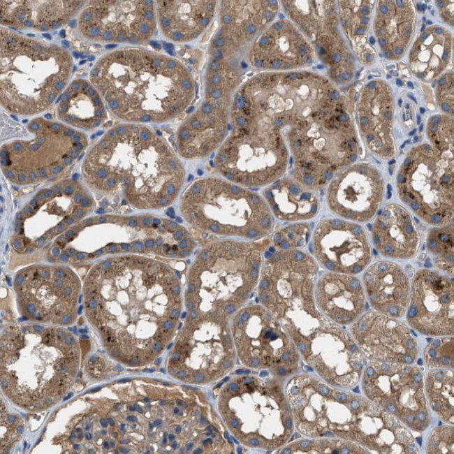 BLOC1S1 Antibody in Immunohistochemistry (IHC)