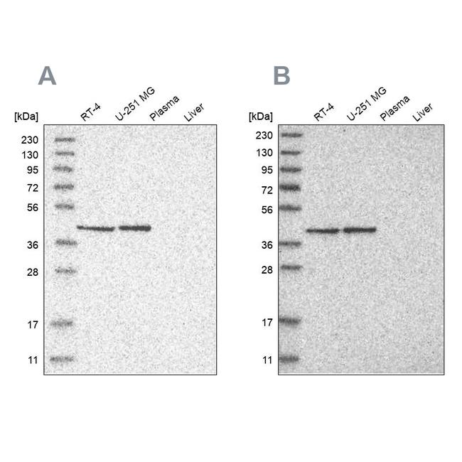 ERAL1 Antibody in Western Blot (WB)