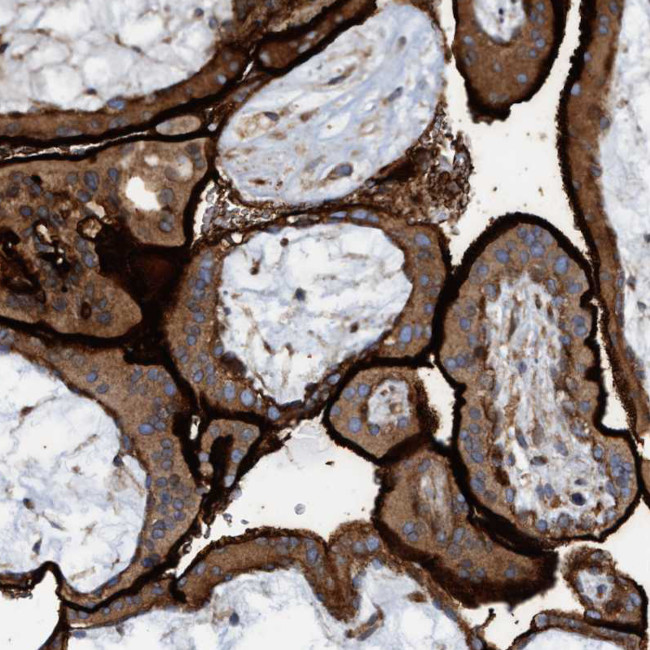 SLC16A3 Antibody in Immunohistochemistry (IHC)