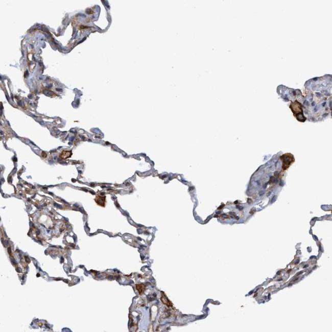 SLC16A3 Antibody in Immunohistochemistry (IHC)