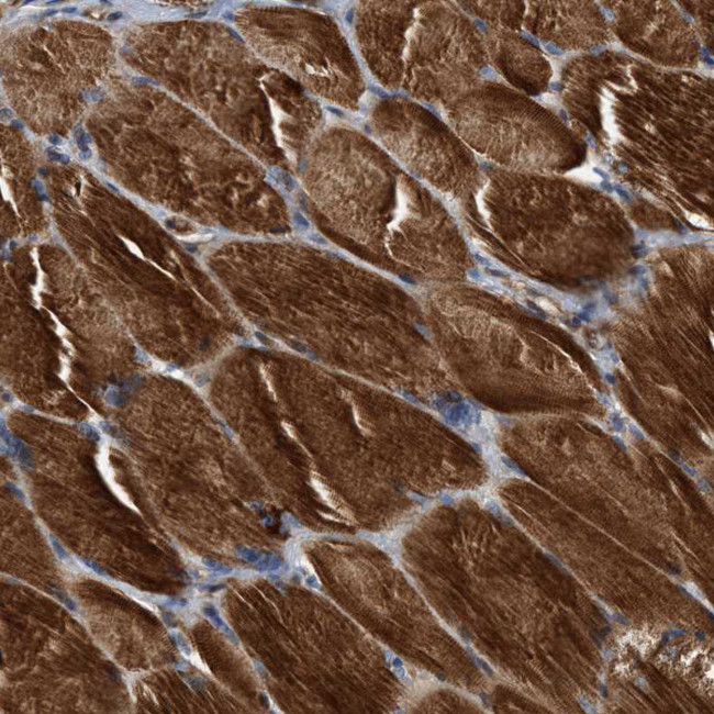 SLC16A3 Antibody in Immunohistochemistry (IHC)