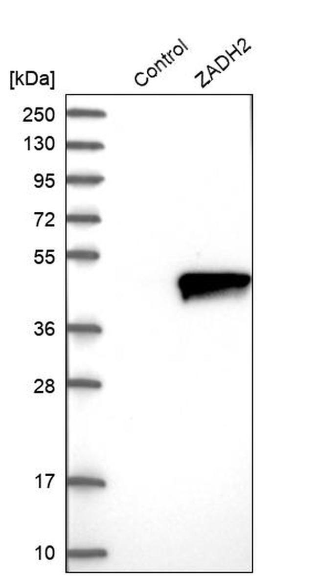 ZADH2 Antibody in Western Blot (WB)