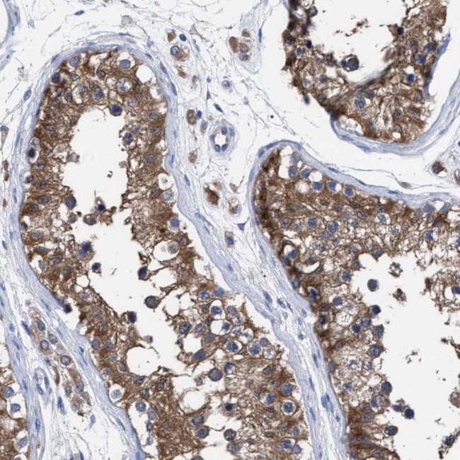 GMPR Antibody in Immunohistochemistry (IHC)