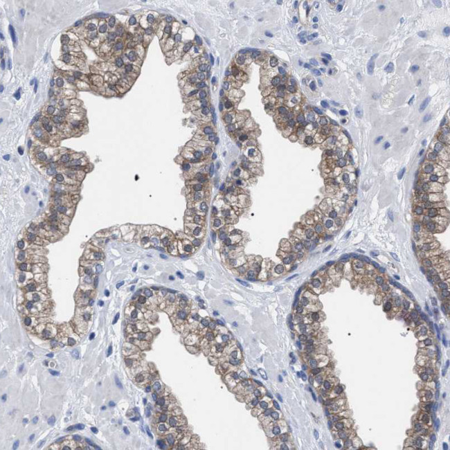 GMPR Antibody in Immunohistochemistry (IHC)